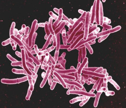 tbc_bacteria